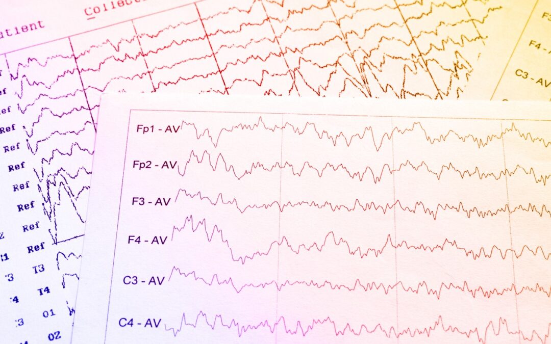 Unique Potential of Sermorelin Peptide in Regulating Sleep