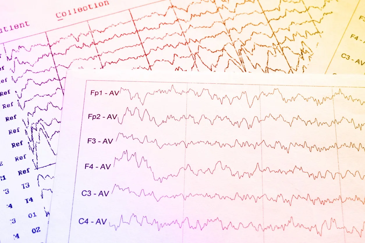 Unique Potential of Sermorelin Peptide in Regulating Sleep