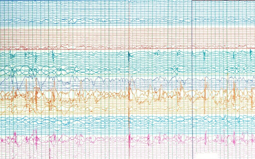 How Do Delta Sleep Inducing Peptides Work?