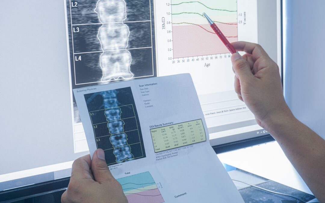 Studies in Ipamorelin for Muscle Growth and Bone Density