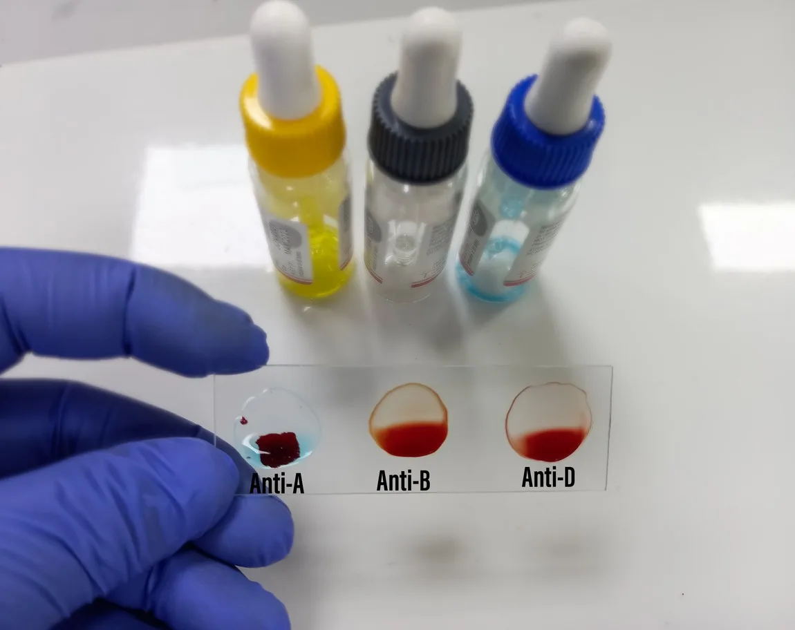 GHRP-2 and CJC 1295 Blend: Growth Hormone Deficiency and Fat Metabolism