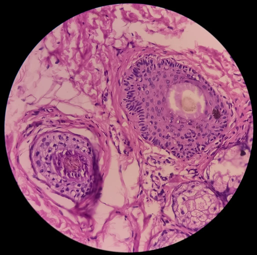 Nonapeptide-1 Research on Skin Pigmentation